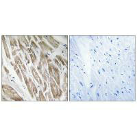 NDUFS5 Antibody