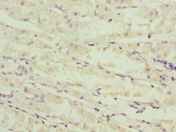 NDUFS6 antibody