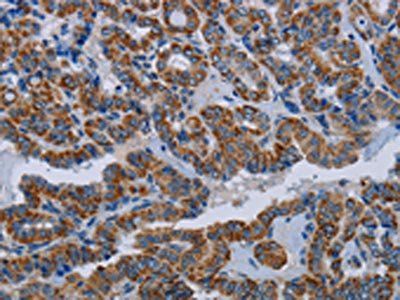 NDUFS8 Antibody