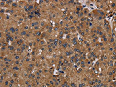 NDUFS8 Antibody