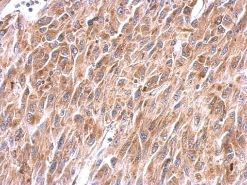 NADH:ubiquinone oxidoreductase core subunit S8 Antibody