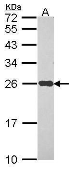 NADH:ubiquinone oxidoreductase core subunit S8 Antibody