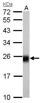 NADH:ubiquinone oxidoreductase core subunit S8 Antibody