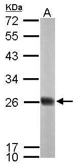 NADH:ubiquinone oxidoreductase core subunit S8 Antibody