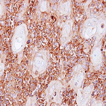 NDUFS8 Rabbit Polyclonal Antibody