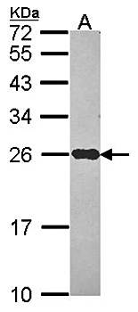 NDUFS8 Rabbit Polyclonal Antibody