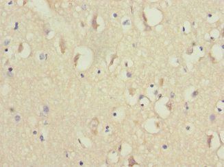 NDUFV1 Antibody