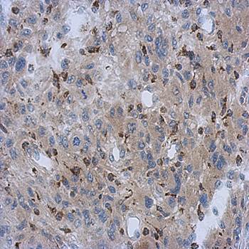 NDUFV1 antibody