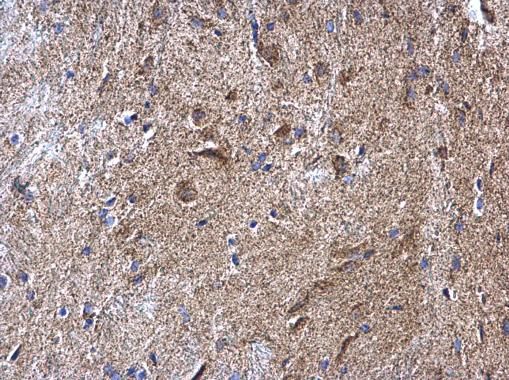 NDUFV2 antibody