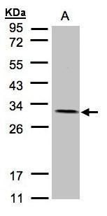 NADH:ubiquinone oxidoreductase core subunit V2 Antibody