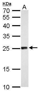 NADH:ubiquinone oxidoreductase core subunit V2 Antibody