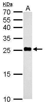 NADH:ubiquinone oxidoreductase core subunit V2 Antibody