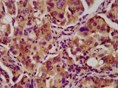 NEB Antibody
