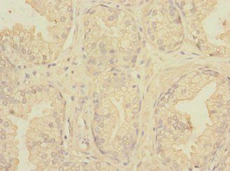 NECTIN3 Antibody