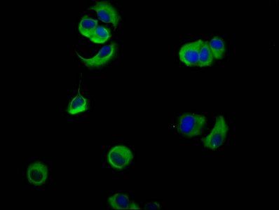 NECTIN4 antibody