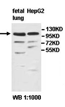 NEDD4 Rabbit Polyclonal Antibody