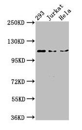 NEDD4L antibody