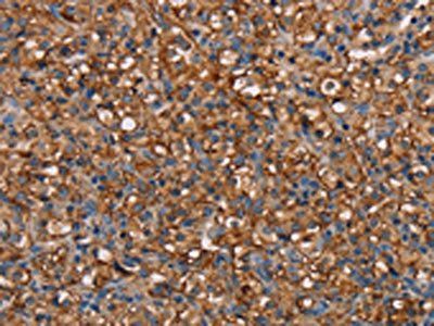 NEDD4L Antibody