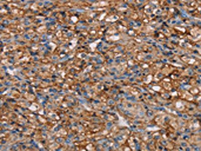 NEDD4L Antibody
