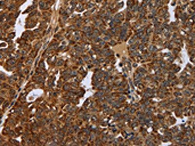 NEFH Antibody