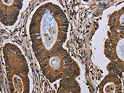 NEFH Antibody