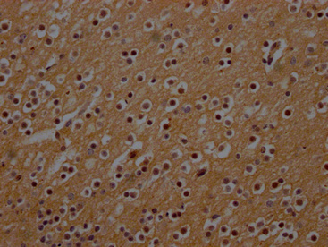 NEFH antibody