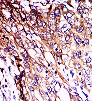 NEFL Antibody