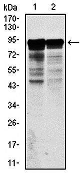 NEFL Antibody