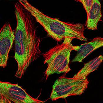 NEFL Antibody