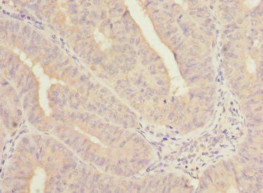 NELFB Antibody