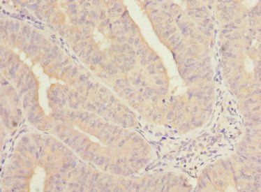 Negative elongation factor B antibody