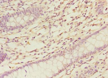 NELFB Antibody