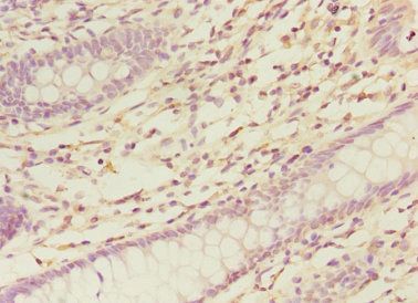 Negative elongation factor B antibody