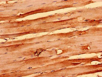 NEGR1 Antibody
