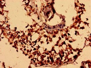 NEGR1 antibody