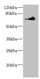 NEK11 Antibody