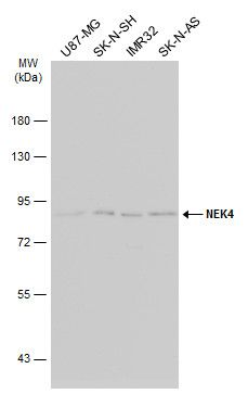 NEK4 antibody [N2C1], Internal