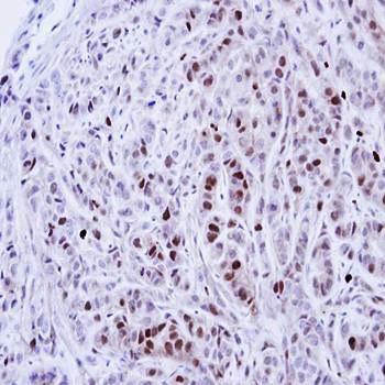 NEK4 Rabbit Polyclonal Antibody