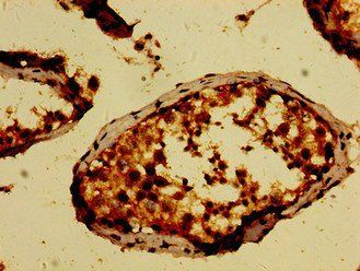 NEK9 Antibody