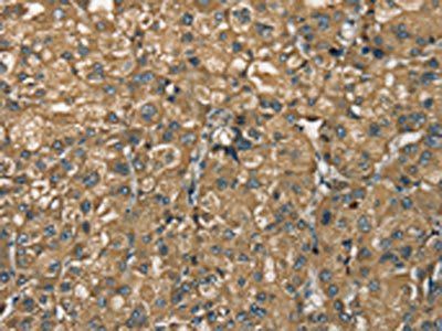 NEMF Antibody