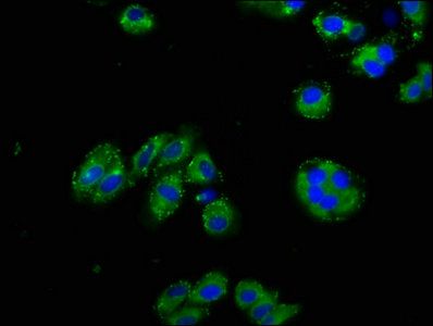 NPHS1 Antibody