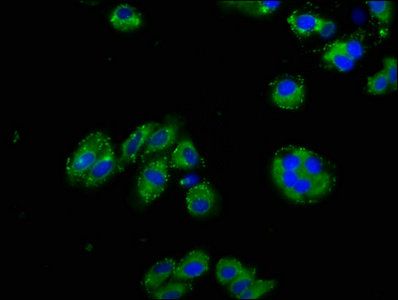 Nephrin antibody