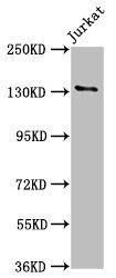 Nephrin antibody