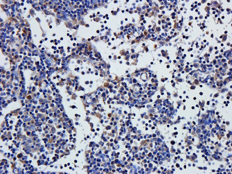 Nephrin antibody