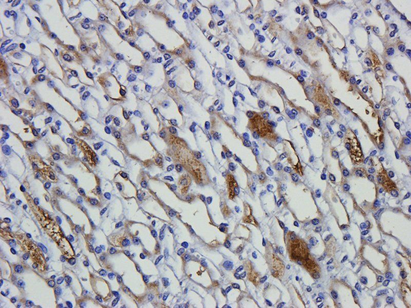 Nephrin antibody