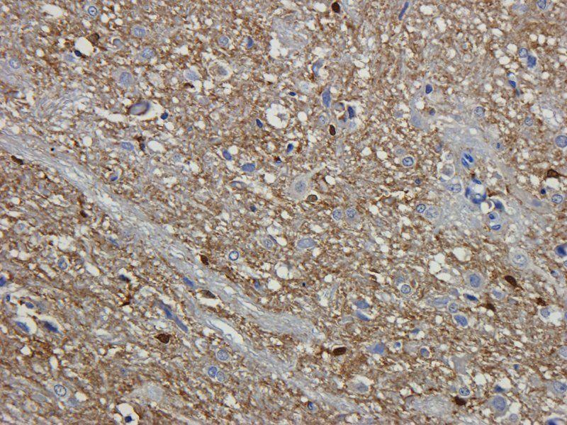 Nephrin antibody