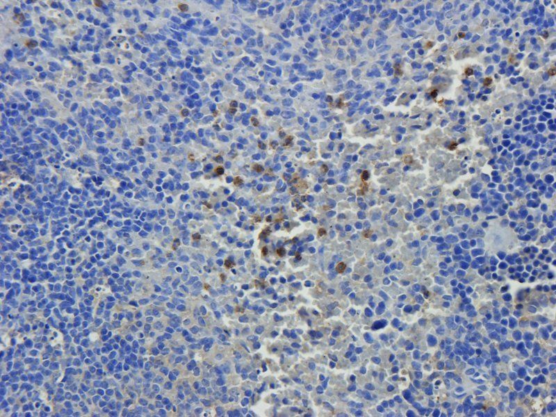 Nephrin antibody