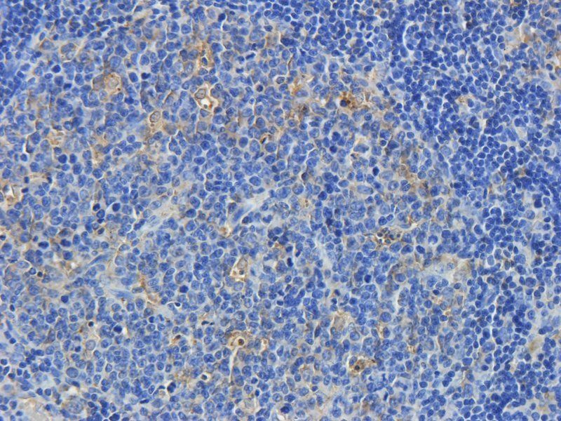 Nephrin antibody