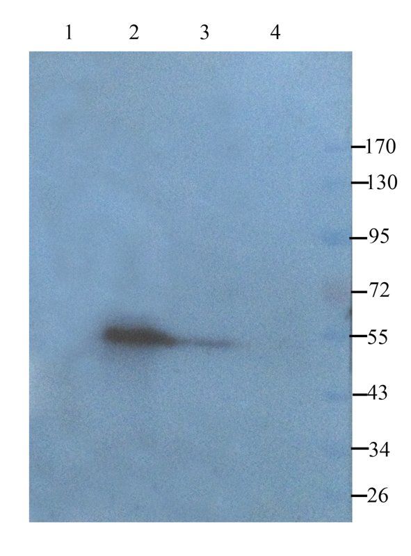 Nephrin antibody