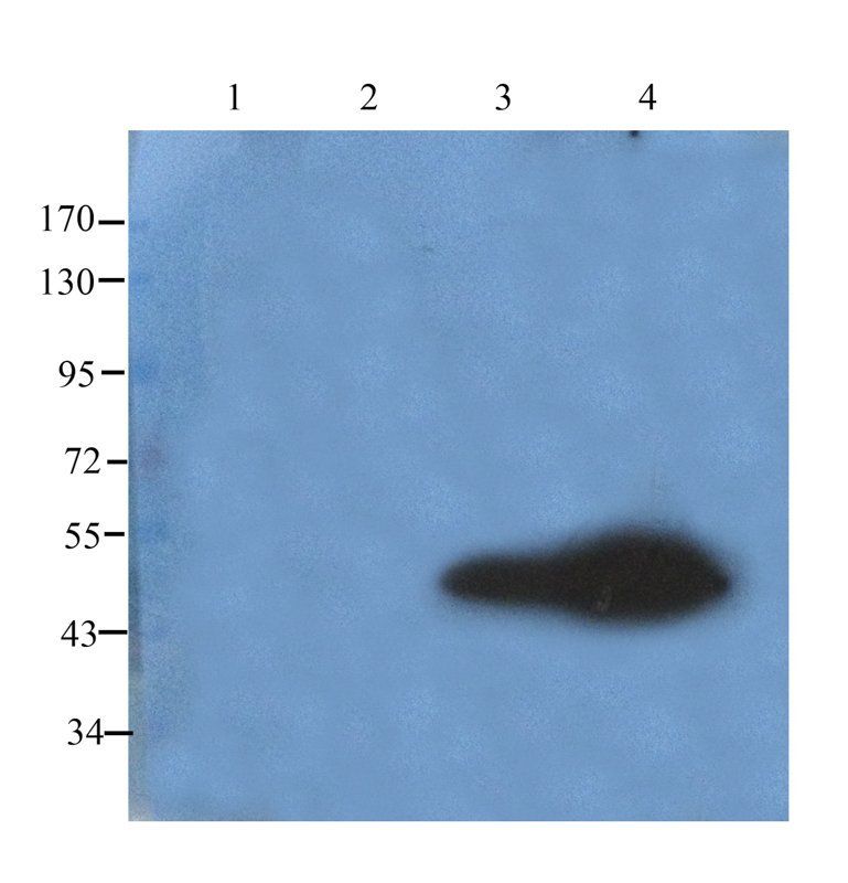 Nephrin antibody